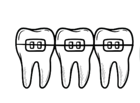 تقويم الاسنان 