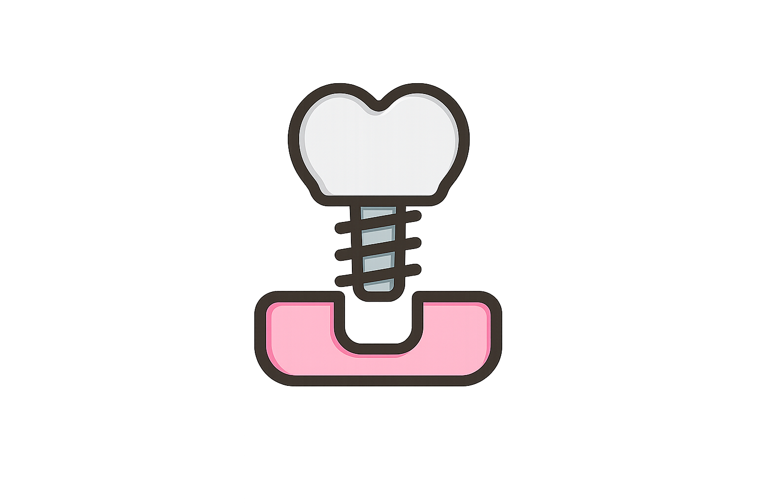 زراعة الاسنان